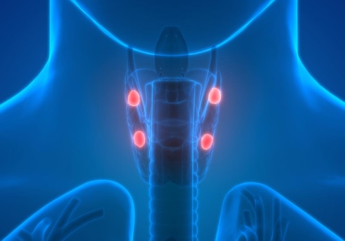 Understanding Hypercalcemia: Causes, Symptoms, and Treatment